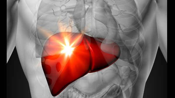 If you have these symptoms you probably have fatty liver be careful