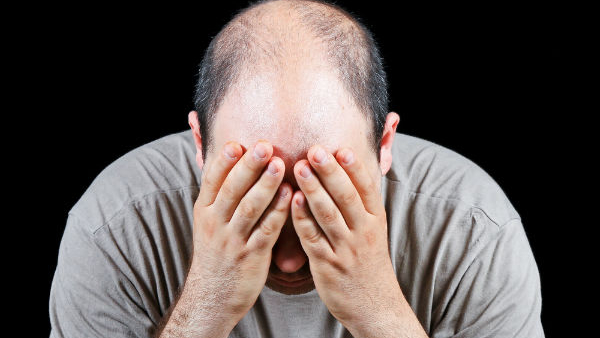 Guntagalagara leaves that make hair grow even on bald heads