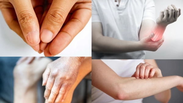 How do you know if you have a protein deficiency What are the symptoms