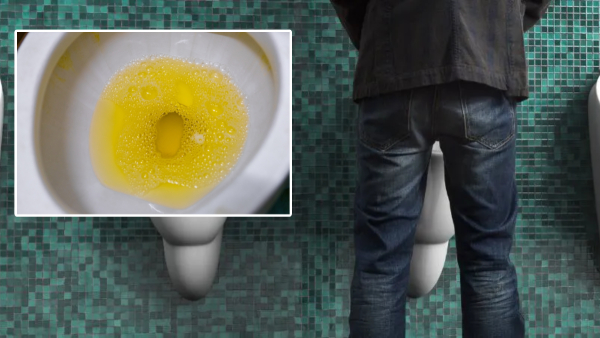 Are these symptoms visible in urine But be alert