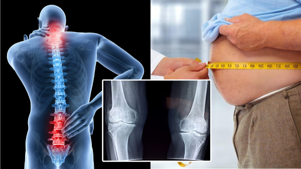 Weight gain is dangerous for bones Be careful