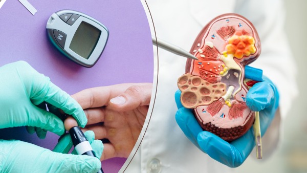 does-diabetes-damage-the-kidneys-is-it-life-threatening