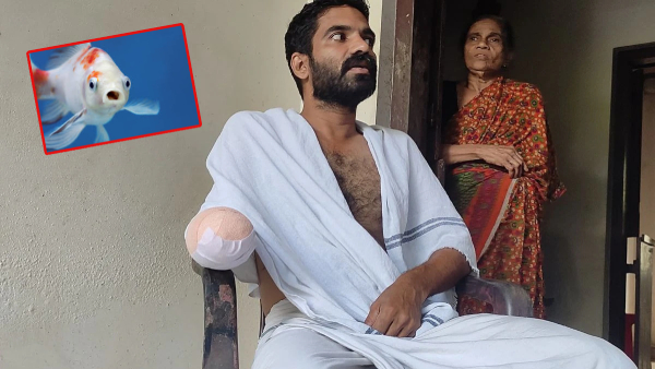 Kerala man loses palm to rare infection Kerala man loses palm to rare infection