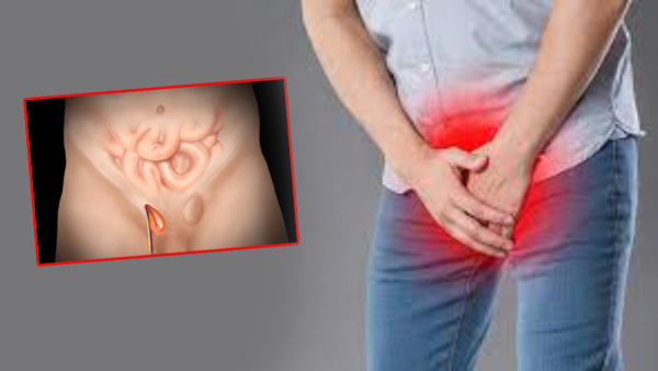 Some factors that contribute to the occurrence of Vari Bijam