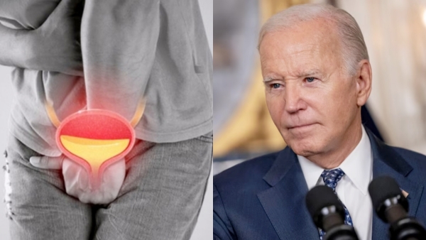 Prostate Cancer Explained 5 Things You Must Know