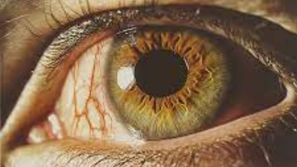 Do you know about eye tuberculosis If ignored you will lose your sight Do you know about eye tuberculosis If ignored you will lose your sight