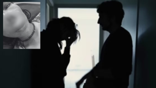 Husband Bites Off Wife s Nose in Karnataka Shocking Reason Behind the Attack