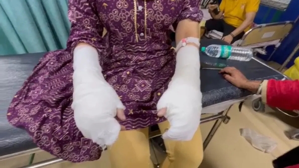 Horror in Delhi Delhi University Student Attacked with Acid Horror in Delhi Delhi University Student Attacked with Acid