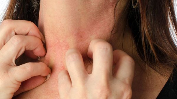 If your blood sugar is not under control you may notice these signs on your skin be careful If your blood sugar is not under control you may notice these signs on your skin be careful