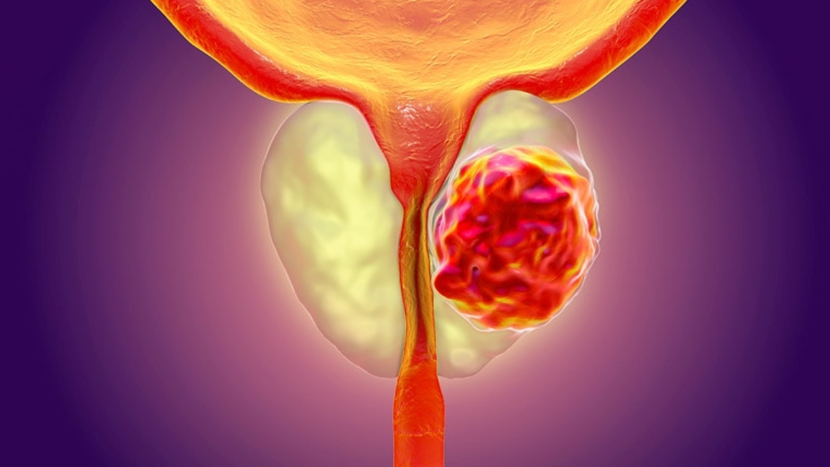 క్యాన్సర్ నుంచి కోలుకున్న ప్రధాని... పోస్ట్ వైరల్ !!