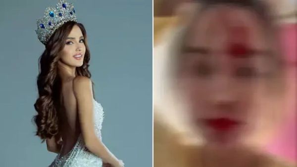 miss-venezuela-2025-winner-shares-shocking-video-that-injuries-on-face-at-cannes-film-festival-and-v