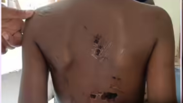 mother tortures son for lover attacked with blade on private parts boy injured police filed case