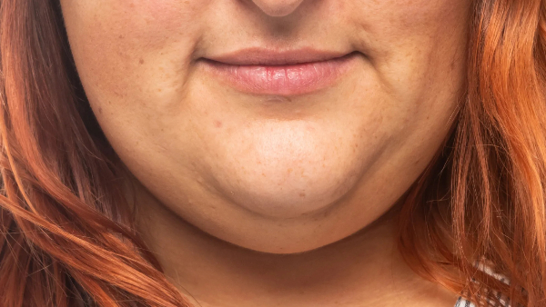 double chin reducing natural tips causes for double chin home remedies to reduce double chin double chin reducing natural tips causes for double chin home remedies to reduce double chin