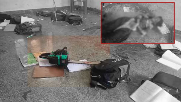 Class 10 Student Severely Injured After Brutal Attack With Saw Inside School Classroom in Raptadu Class 10 Student Severely Injured After Brutal Attack With Saw Inside School Classroom in Raptadu