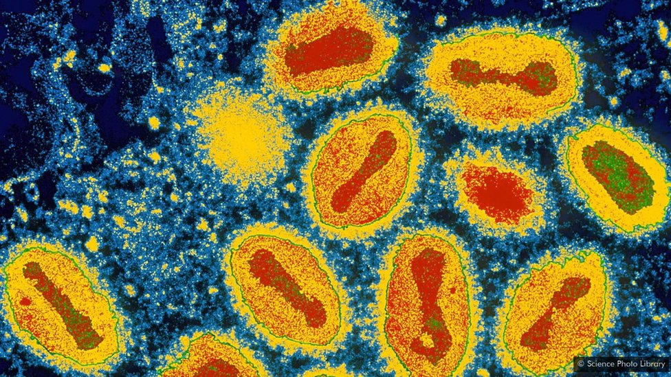 వైరస్ వైరస్