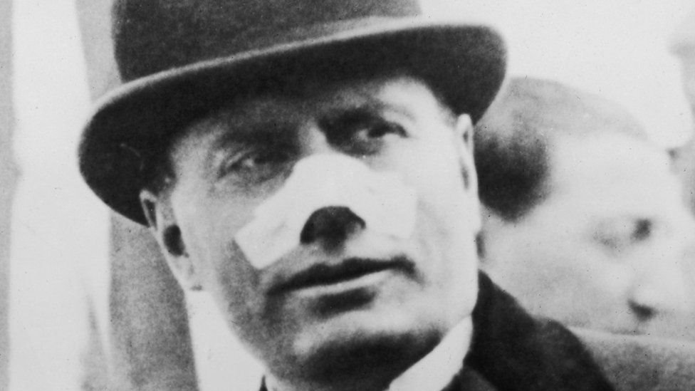 1926లో గిబ్సన్ జరిపిన కాల్పుల్లో బుల్లెట్ ముస్సోలినీ ముక్కును రాసుకుంటూ వెళ్లింది 1926లో గిబ్సన్ జరిపిన కాల్పుల్లో బుల్లెట్ ముస్సోలినీ ముక్కును రాసుకుంటూ వెళ్లింది