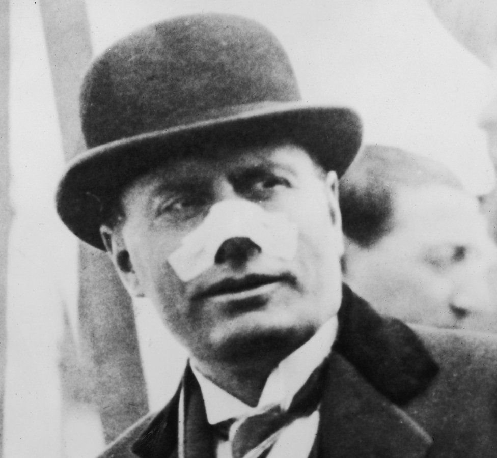 ముక్కుపై బుల్లెట్ గాయంతో ముస్సోలినీ ముక్కుపై బుల్లెట్ గాయంతో ముస్సోలినీ