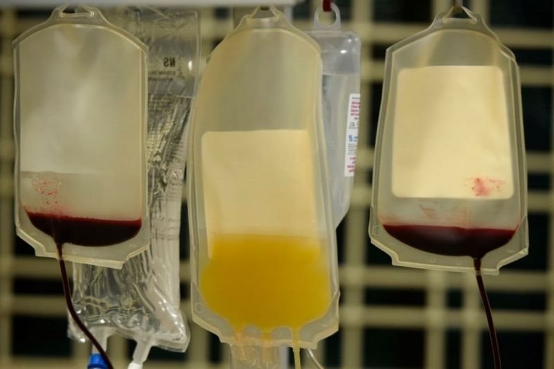 ప్లాస్మా థెరపీ