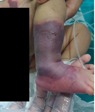 గర్భదారణ సమయంలో గానీ, డెలివరీ సందర్భంగా గానీ తల్లికి ఎటువంటి ఆరోగ్య సమస్యలు లేవని చిన్నారి తండ్రి వెల్లడించారు.