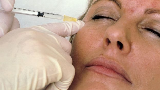 బోటాక్స్ ఇంజెక్షన్
