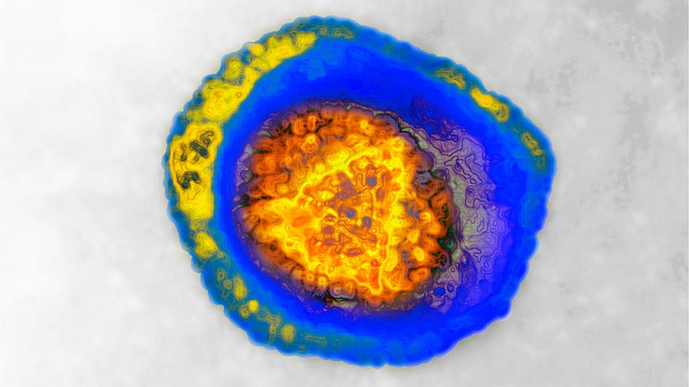 హెర్పెస్ వైరస్/herpes virus హెర్పెస్ వైరస్/herpes virus