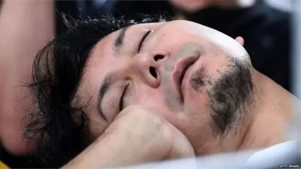 గురక పెట్టకుండా ఉండాలంటే