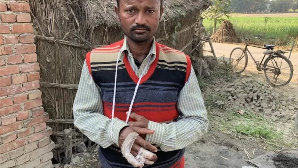 పశువుల దాడిలో గాయపడ్డ శివపూజన్