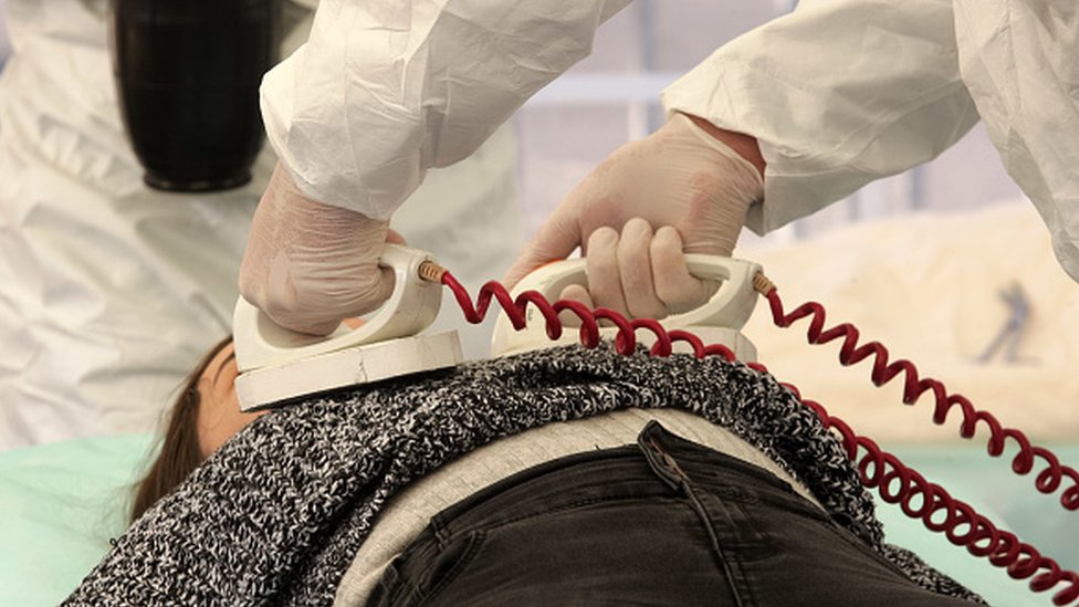 డీఫిబ్రిలేషన్