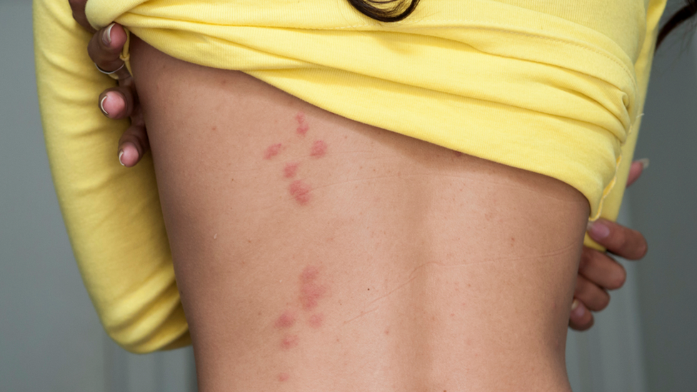 బెడ్‌బగ్స్