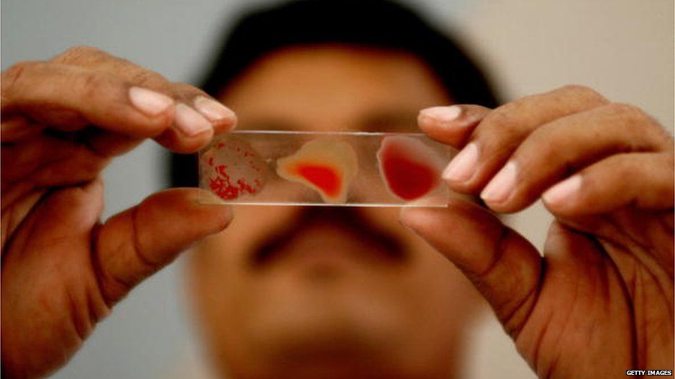 బ్లడ్ గ్రూప్