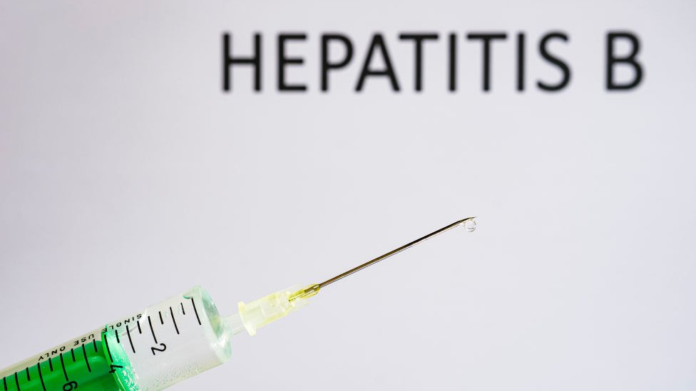 హెపటైటిస్