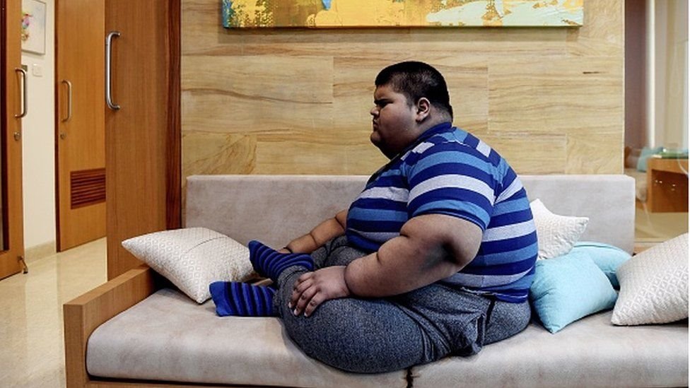 ఊబకాయం ఊబకాయం