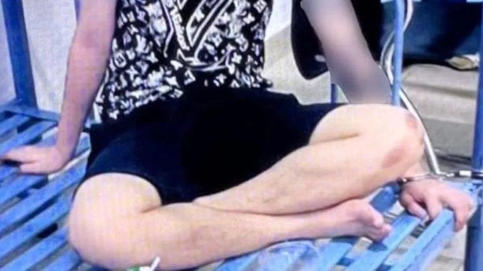 వియత్నాంకు చెందిన వ్యక్తిని ఇనుప మంచానికి కట్టేసి విద్యుత్ షాక్ ఇచ్చినట్లుగా మోకాళ్లపై గాయాలు కనిపిస్తున్నాయి వియత్నాంకు చెందిన వ్యక్తిని ఇనుప మంచానికి కట్టేసి విద్యుత్ షాక్ ఇచ్చినట్లుగా మోకాళ్లపై గాయాలు కనిపిస్తున్నాయి