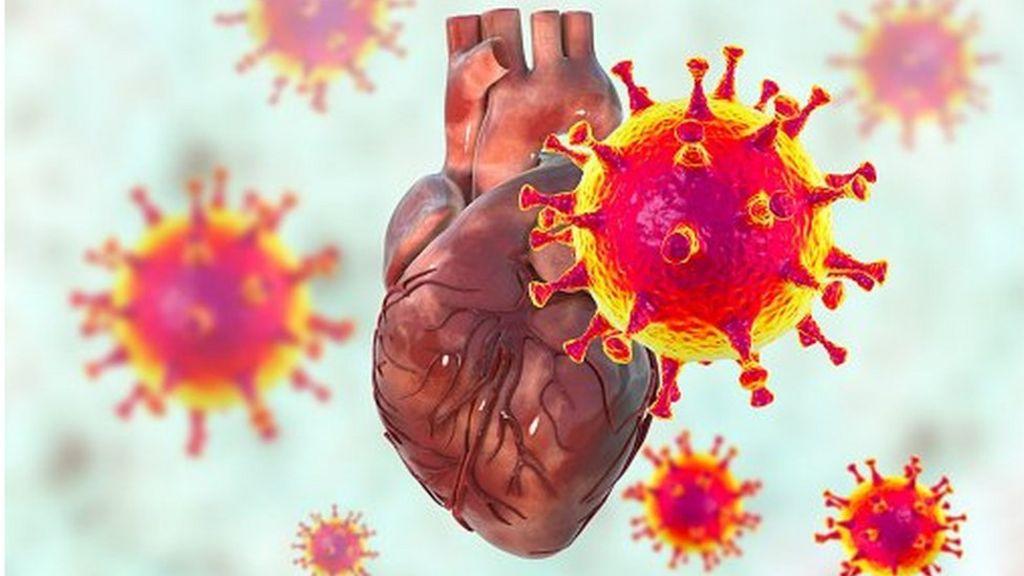 గుండె పోటు