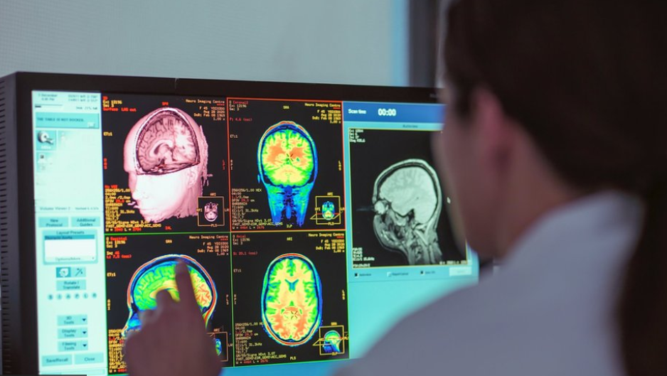 మనిషి మెదడు