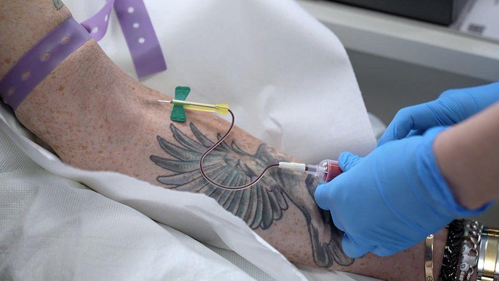 కీమోథెరపీ కీమోథెరపీ