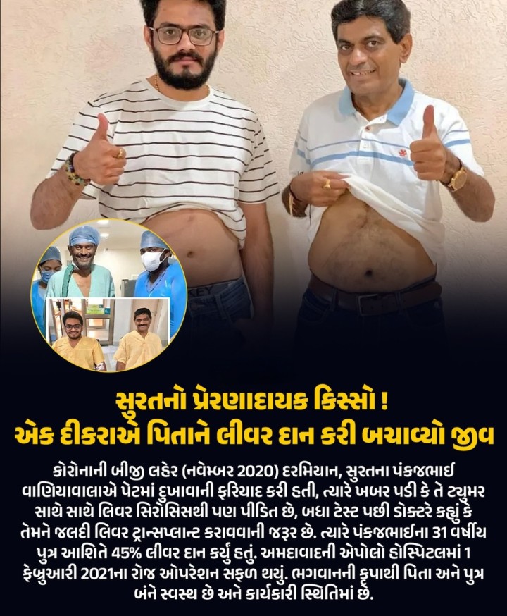 એક દીકરાએ પિતાને લીવર દાન કરી બચાવ્યો જીવ