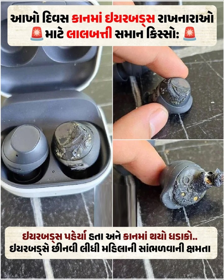 મહિલાના વાયરલેસ ઇયરફોન્સ અચાનક ફાટ્યા, જેના કારણે તેણે કાયમી બહેરાશનો સામનો કરવો પડ્યો.