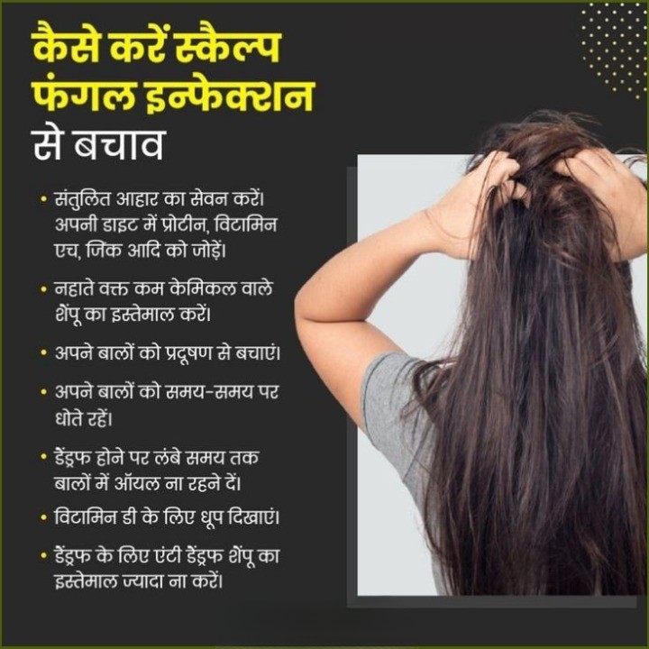 स्कैल्प फंगल इंफेक्शन से बचने के तरीके