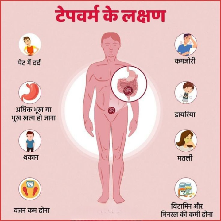 टेपवर्म के लक्षण