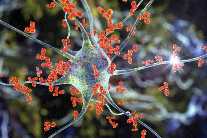 গিলেন-বারি সিনড্রোম (জিবিএস) ক্রমেই চিন্তার কারণ হয়ে উঠছে। এই রোগে আক্রান্ত হয়ে মহারাষ্ট্রে এক জনের মৃত্যু হয়েছে। পুণেতে আক্রান্তের সংখ্যা বেড়ে হয়েছে ১০১ জন, যাঁদের মধ্যে অন্তত ৬০ জনের শারীরিক অবস্থা সঙ্কটজনক।  চিকিৎসকদের অনুমান, ভাইরাস থেকেই হচ্ছে এই রোগ।