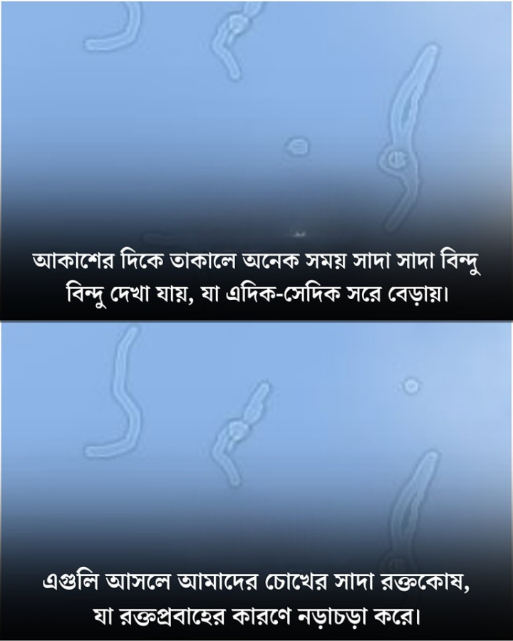 সাদা বিন্দু গুলি আদতে চোখের সাদা রক্তকোষ?