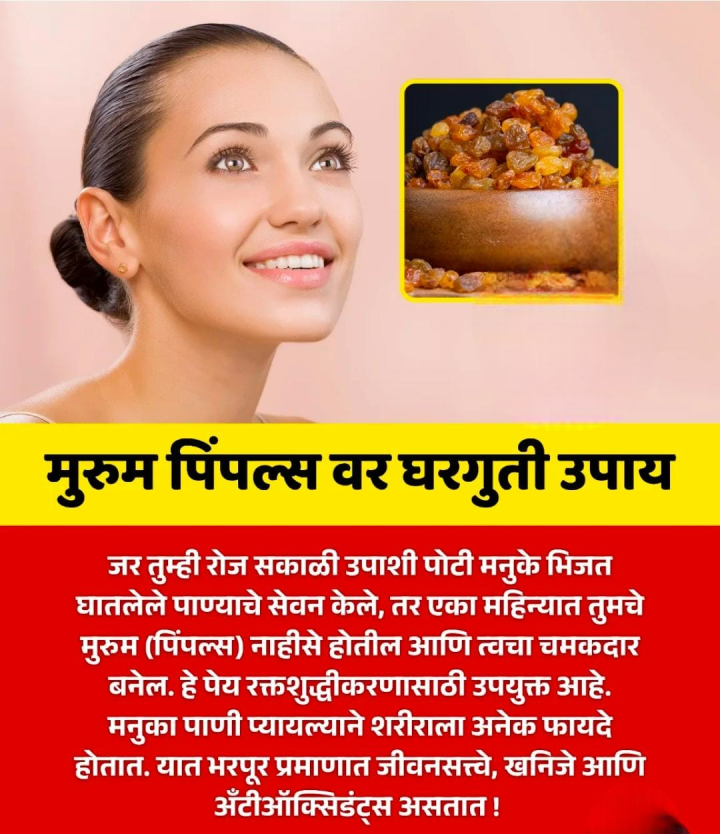 पिंपल्स वरती घरगुती