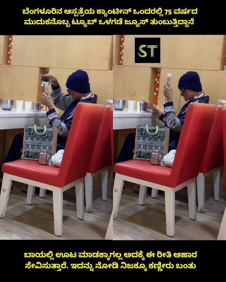 ಬಾಯಲ್ಲಿ ಊಟ ಮಾಡಕ್ಕಾಗಲ್ಲ ಅದಕ್ಕೆ ಈ ರೀತಿ ಆಹಾರ ಸೇವಿಸುತ್ತಾರೆ. ಇದನ್ನು ನೋಡಿ ನಿಜಕ್ಕೂ ಕಣ್ಣೀರು ಬಂತು