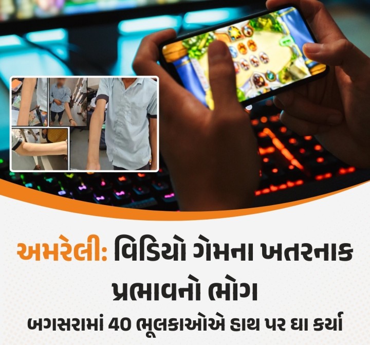 બગસરાના મોટા મુંજિયાસર ગામની પ્રાથમિક શાળામાં ચોંકાવનારી ઘટના સામે આવી છે, જ્યાં એક વિદ્યાર્થીએ વીડિયો ગેમના પ્રભાવમાં આવી પોતાના સાથીઓને હાથ પર બ્લેડથી કાપવા માટે પ્રેરિત કર્યા. તેણે શરત મૂકી કે જે આ ટાસ્ક પૂર્ણ કરશે, તેને 10 રૂપિયા મળશે. પરિણામે, 40 વિદ્યાર્થીઓએ પેન્સિલના શાર્પનરથી પોતાના હાથ પર ઘા કર્યા. આ ઘટના છુપાવવાના પ્રયાસો થયા, પરંતુ અંતે મામલો પોલીસ સુધી પહોંચ્યો. ગામની