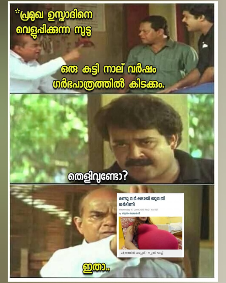 അന്താടാ ഞെട്ടിയോ നീ