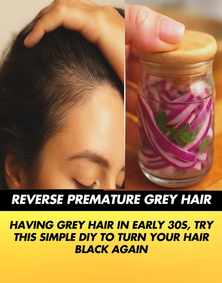 REVERSE PREMATURE GREY HAIR