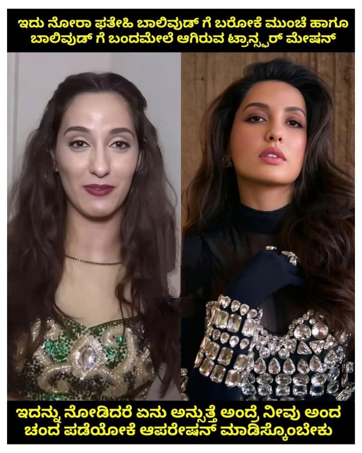 ಇದನ್ನು ನೋಡಿದರೆ ಏನು ಅನ್ಸುತ್ತೆ ಅಂದ್ರೆ ನೀವು ಅಂದ ಚಂದ ಪಡೆಯೋಕೆ ಆಪರೇಷನ್‌ ಮಾಡಿಸ್ಕೊಂಬೇಕು