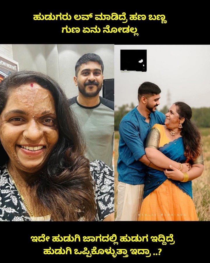 ಇದೇ ಹುಡುಗಿ ಜಾಗದಲ್ಲಿ ಹುಡುಗ ಇದ್ದಿದ್ರೆ ಹುಡುಗಿ ಒಪ್ಪಿಕೊಳ್ಳುತ್ತಾ ಇದ್ರಾ ..?