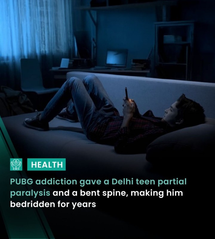 A Delhi teenager underwent spinal surgery after he suffered from partial paralysis from gaming addiction from playing PUBG daily for more than 12 hours and remained isolated from his family. Over time, this condition led to a bent spine along with losing control over his bladder - signs that the spinal cord was under pressure.
